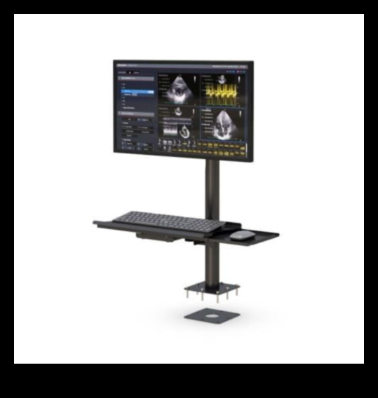 التميز المريح: حوامل وحوامل قابلة للتعديل للعرض المخصص